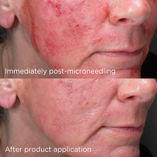 Image | Daily Prevention Advanced Smart Blend Mineral Moisturiser SPF 50+
