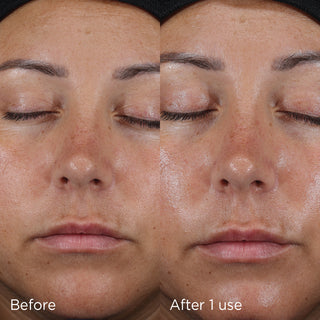 Image | Daily Prevention Ultra Defense Moisturizer SPF50