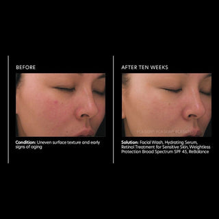 PCA | Retinol Treatment for Sensitive Skin